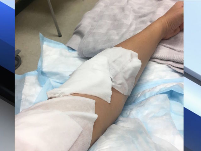 Woman injured on Southwest Air flight from PHX