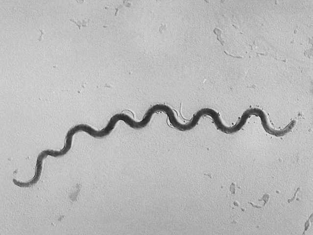 Newborn syphilis cases reach highest level in 20 years